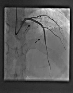 CLD Saleem et al Figure 5 Final Result