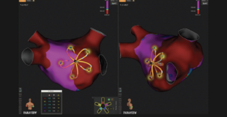 Frankel-Fig3-Dec 2025