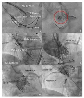 Stathogiannis Figure
