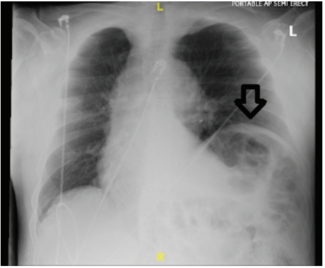 Ali - Fig 1 - JanFeb 2026.png 