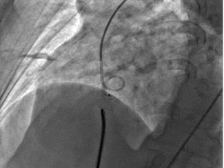 Figure 4A CLD Imran Hanif