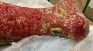 Figure 1 Preview Image