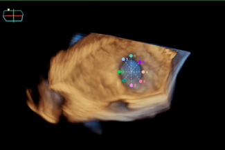 Imaging Corner Mar-Apr Figure 1D