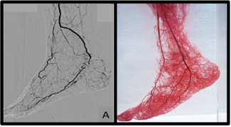 Figure. Angiography vs microvascular beds. 