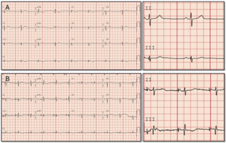 Farjo-Fig2-EPLD-April 2026.png 