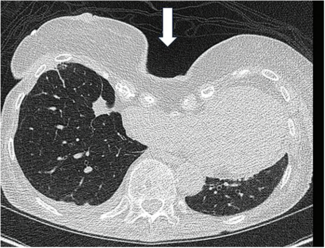 Kern-Fig1-CLD-MarchApril 2026