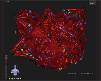 Sadhu-Fig1-EPLD-April 2026.png 