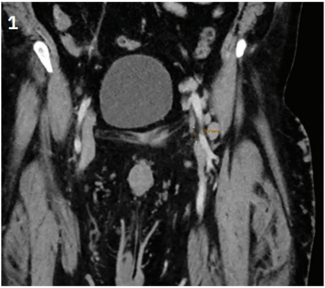 Tiede-Fig1-CLD-MarchApril 2026