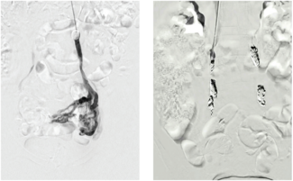 Winokur-Fig1-CLD-MarchApril 2026