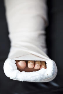 Controlling Edema in Total Ankle Arthroplasty 