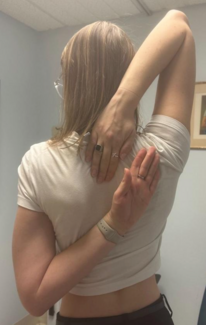 Cohen_Figure.hypermobile Ehler-Danlos syndrome