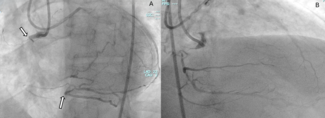 Figure 1.segment_occlusion