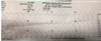 12 lead read of a patient with a pacemaker in the back of an ambulance on the interstate