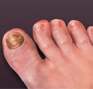 nail