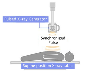 Konica Minolta’s Dynamic Digital Radiography