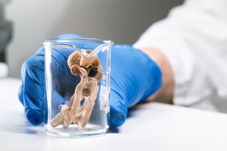 psilocybin mushrooms in a beaker