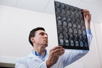 a doctor reviews brain scans