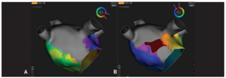 Bhatti-Fig1-EPLD-Aug 2026.png (194.48 KB) 