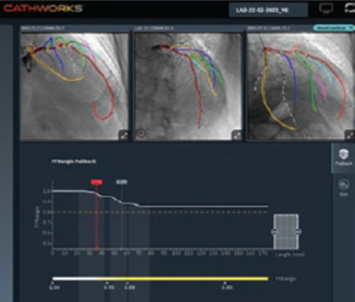 CLD Kern Seto CathWorks (Medtronic) image