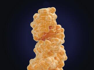 Psoriasis