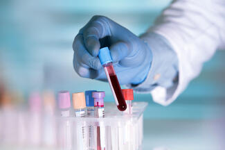 a researcher holds up a test tube of blood