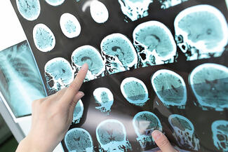 a hand points to a specific spot on a brain scan