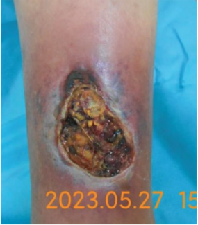Figure 1 of article