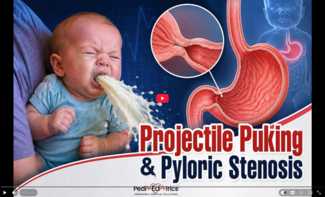 Pyloric stenosis… Many of us briefly learned of this condition in school, but most likely, few of us have ever actually cared for a baby with it.  With that in mind, here’s a rapid review of the key aspects of pyloric stenosis as you’ve never seen them before… From the inside out!