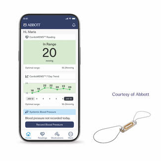 CardioGuide with PA Sensor (Abbott)