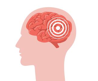 Head in profile with brain visible and target over brain