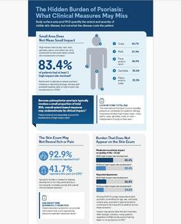 Hidden Burden of Psoriasis Infographic image