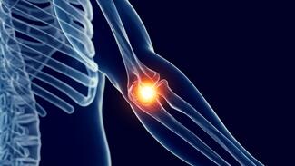 Illustration-depicting-elbow-pain