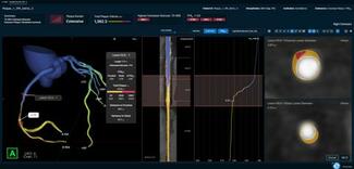 Elucid FFR-IQ