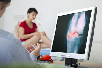 x-ray-showing-arthritis-of-the-knee
