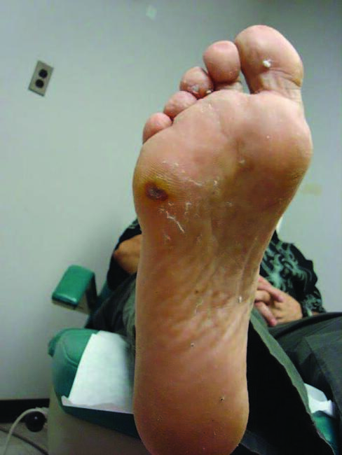 wound4.jpg?itok=yGMhpary