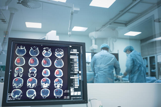 Minimally Invasive Neurosurgery Approach Could Assist Maximal, Safe ...