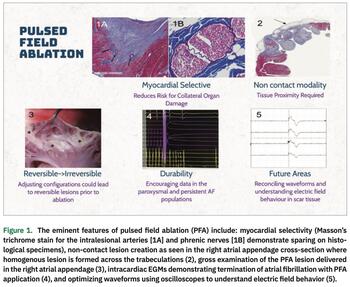 Mehta - Pulsed Field Ablation - Figure 1
