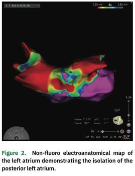 Salzberg - Therapies for Atrial Fibrillation - Figure 3