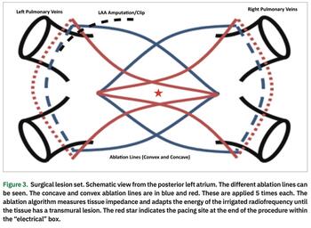 Salzberg - Therapies for Atrial Fibrillation - Figure 4