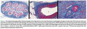 Mehta - Pulsed Field Ablation - Figure 4