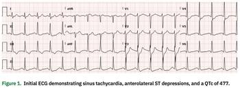 Prousi - Ventricular Tachycardia - Figure 1