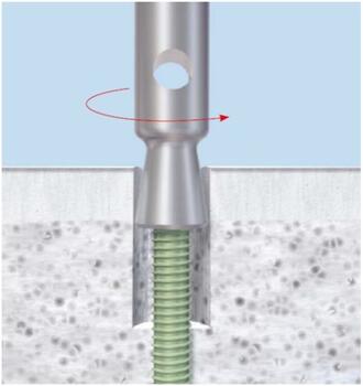 An extraction bolt is used once enough of the screw shaft is exposed via reaming. The reverse threads within the bolt will engage the screw when turned counterclockwise. Image courtesy of DePuy Synthes.