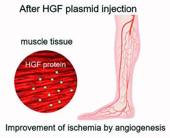These figures further detail the use of HGF Plasmid (Collategene®), approved in Japan and currently undergoing evaluation in a Phase II clinical trial in the United States. The purpose of the study is to evaluate patients with mild to moderate CLTI, as defined by the WIfI classification, grade 1 or 2. Figure courtesy of AnGes Japan.