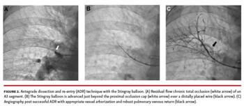Steinberg - Figure 2