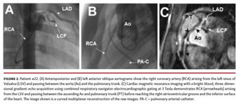 Al-Mubarek - Figure 2