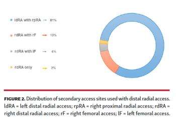 Circle graph showing distribution of secondary access sites used with distal radial access