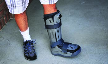 Studies on weight-bearing after ankle fracture ORIF examine the type of fixation, time of non-weight-bearing, and type of immobilization or protective device, such as the cast boot walker seen in this photo.