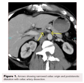 Farquharson Figure 1