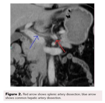 Farquharson Figure 2