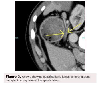 Farquharson Figure 3